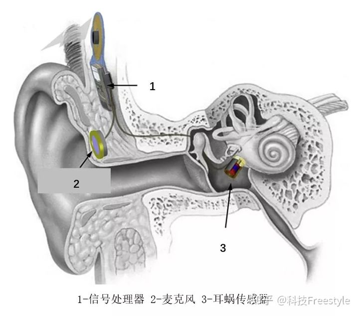 v2-f7c8e112bf03935b1c1768574b6df1c8_720w